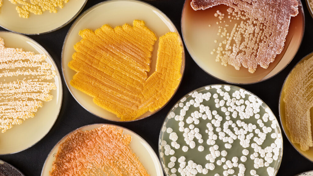 A collection of plates streaked with various microbes of different phenotypes, from a project searching for novel antibiotic small molecules